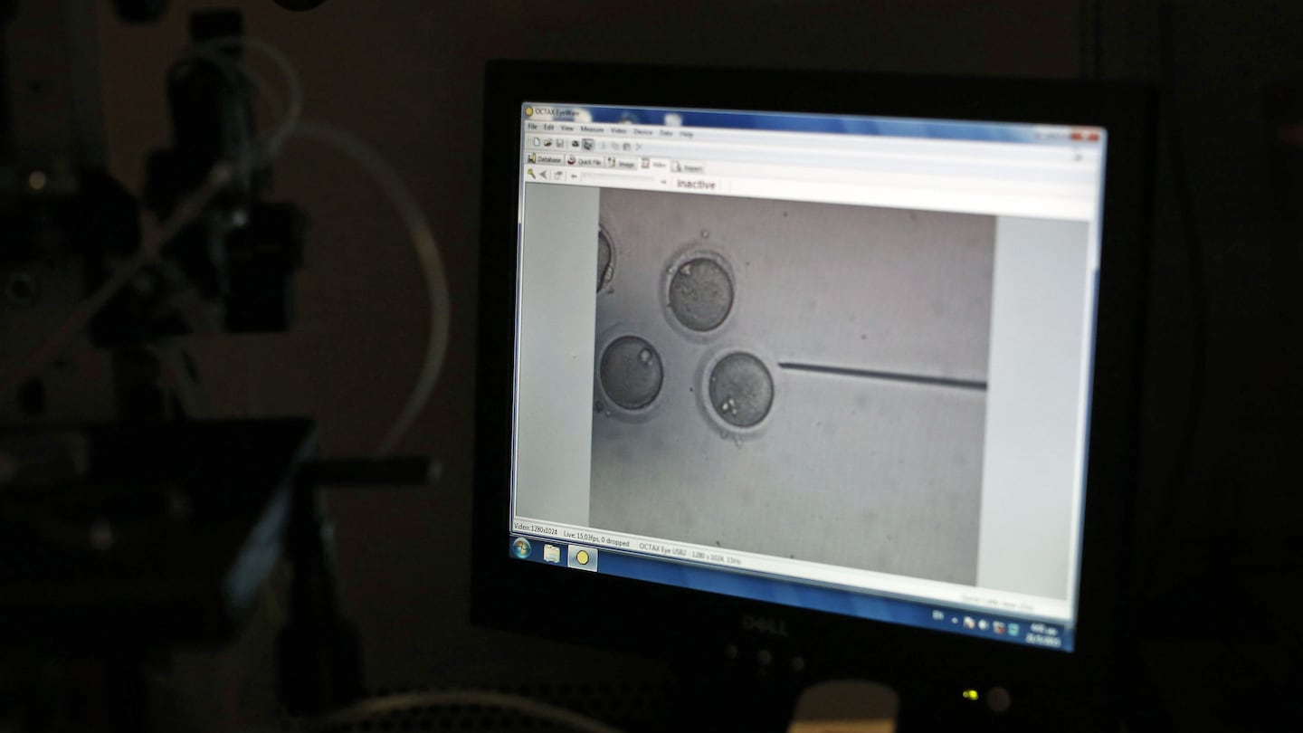 Human eggs on a computer screen during the fertilization process in a laboratory for in vitro fertilization.