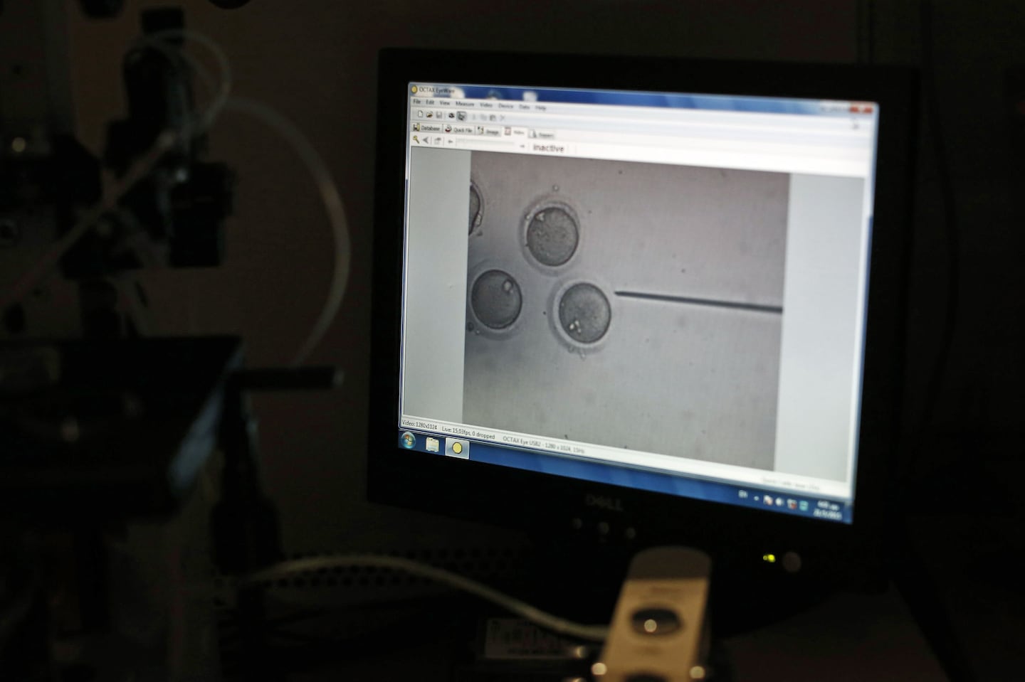 Human eggs on a computer screen during the fertilization process in a laboratory for in vitro fertilization.